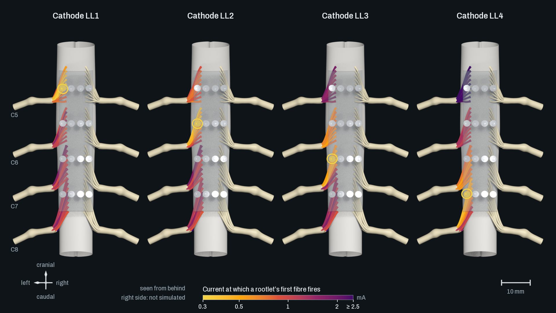 The spinal cord seen from behind, four times side by side, each with the paddle’s 16 contacts and four pairs of nerve roots. In each, a different contact of the left column is ringed as cathode, and the rootlets on the left are coloured by the current at which they respond. The brightest rootlets lie next to the ringed contact and move down from the first picture to the fourth.